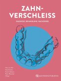 Zahnverschleiß (eBook, ePUB)