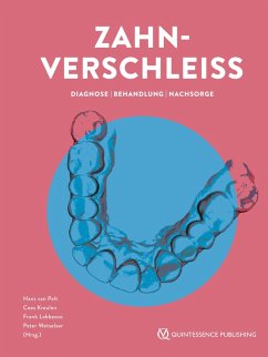 Cover Zahnverschleiß (eBook, ePUB)