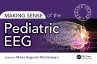 Making Sense of the Pediatric EEG... - Bild 1