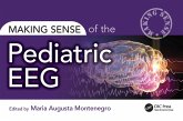 Making Sense of the Pediatric EEG (eBook, ePUB)