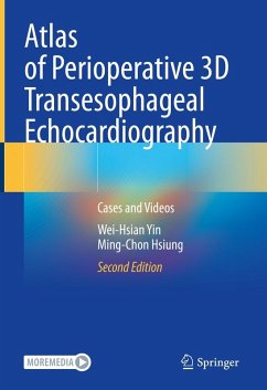 Cover Atlas of Perioperative 3D Transesophageal Echocardiography (eBook, PDF)