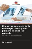 Une revue complète de la radiologie cardiaque et pulmonaire chez les patients