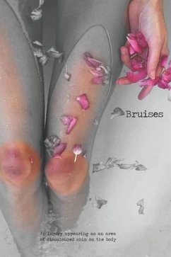 Bruises - Poetry Publishing, Dark Thirty; Shove, Adam