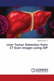 Liver Tumor Detection from CT Scan images using DIP