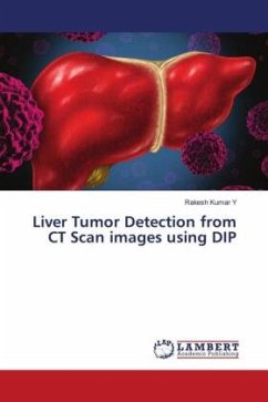 Liver Tumor Detection from CT Scan images using DIP - Y, Rakesh Kumar