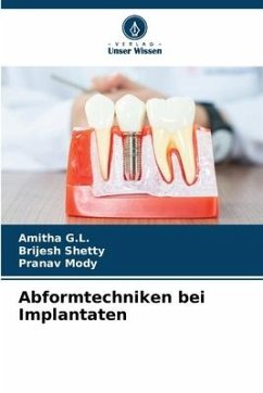 Abformtechniken bei Implantaten - G.L., Amitha;Shetty, Brijesh;Mody, Pranav