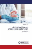 An insight in post endodontic restoration