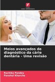 Meios avançados de diagnóstico da cárie dentária - Uma revisão