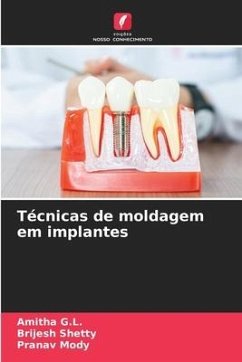 Técnicas de moldagem em implantes - G.L., Amitha;Shetty, Brijesh;Mody, Pranav