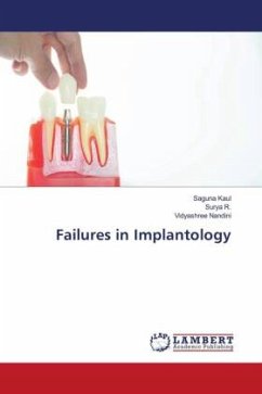 Failures in Implantology