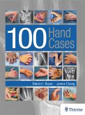 100 Hand Cases (eBook, ePUB)