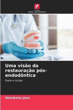 Uma visão da restauração pós-endodôntica - Joon, Akanksha