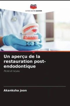 Un aperçu de la restauration post-endodontique - Joon, Akanksha