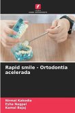 Rapid smile - Ortodontia acelerada