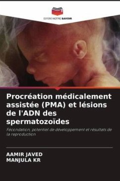 Procréation médicalement assistée (PMA) et lésions de l'ADN des spermatozoïdes - Javed, Aamir;KR, MANJULA
