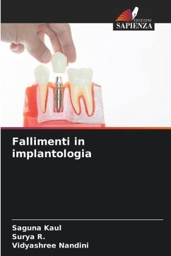 Fallimenti in implantologia - Kaul, Saguna;R., Surya;Nandini, Vidyashree
