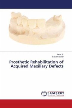Prosthetic Rehabilitation of Acquired Maxillary Defects - K., Amal;Shetty, Sanath