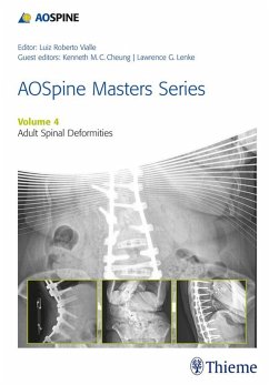 AOSpine Masters Series, Volume 4: Adult Spinal Deformities (eBook, ePUB)