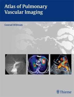 Cover Atlas of Pulmonary Vascular Imaging (eBook, ePUB)