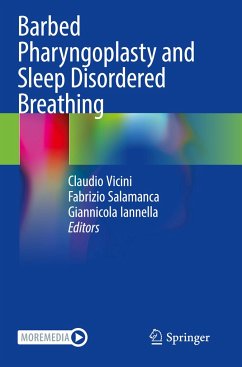 Barbed Pharyngoplasty and Sleep Disordered Breathing