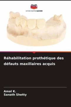 Réhabilitation prothétique des défauts maxillaires acquis - K., Amal;Shetty, Sanath