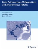 Brain Arteriovenous Malformations and Arteriovenous Fistulas (eBook, ePUB)