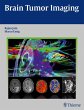 Brain Tumor Imaging (eBook, ePUB) - Bild 1