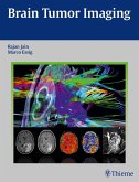 Brain Tumor Imaging (eBook, ePUB)