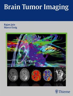 Cover Brain Tumor Imaging (eBook, ePUB)