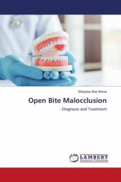 Open Bite Malocclusion - Aher Borse, Shivpriya