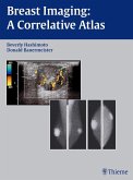 Breast Imaging (eBook, ePUB)