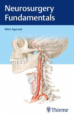 Neurosurgery Fundamentals (eBook, ePUB) - Agarwal, Nitin