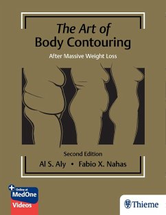 The Art of Body Contouring: After Massive Weight Loss (eBook, PDF)