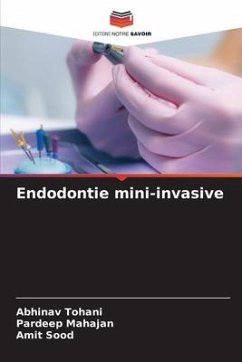 Endodontie mini-invasive - Tohani, Abhinav;Mahajan, Pardeep;Sood, Amit
