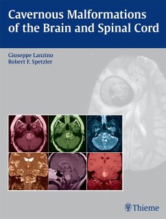 Cavernous Malformations of the Brain and Spinal Cord (eBook, ePUB)