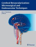 Cerebral Revascularization: Microsurgical and Endovascular Techniques (eBook, ePUB)