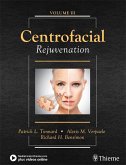 Centrofacial Rejuvenation (eBook, ePUB)