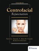 Centrofacial Rejuvenation (eBook, PDF)