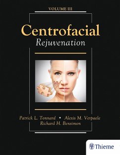 Centrofacial Rejuvenation (eBook, PDF) - Tonnard, Patrick; Verpaele, Alexis; Bensimon, Richard