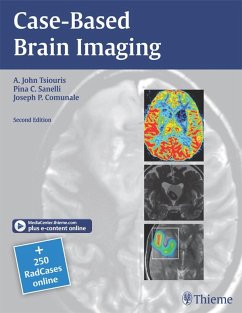 Case-Based Brain Imaging (eBook, ePUB) - Tsiouris, A. John; Sanelli, Pina C.; Comunale, Joseph