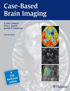 Case-Based Brain Imaging (eBook, PDF) - Tsiouris, A. John; Sanelli, Pina C.; Comunale, Joseph