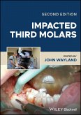 Impacted Third Molars (eBook, ePUB)