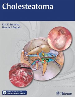 Cholesteatoma (eBook, ePUB) - Smouha, Eric E.; Bojrab, Dennis I.