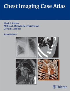 Chest Imaging Case Atlas (eBook, ePUB) - Parker, Mark S.; Rosado-De-Christenson, Melissa L.; Abbott, Gerald F.