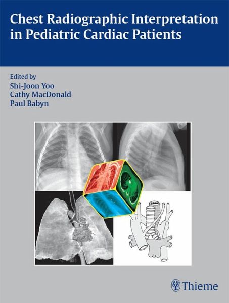 Chest Radiographic Interpretation in Pediatric Cardiac Patients (eBook, ePUB) Chest Radiographic Interpretation in Pediatric Cardiac Patients (eBook, ePUB)