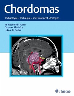 Chordomas (eBook, ePUB)