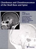 Chordomas and Chondrosarcomas of the Skull Base and Spine (eBook, ePUB)