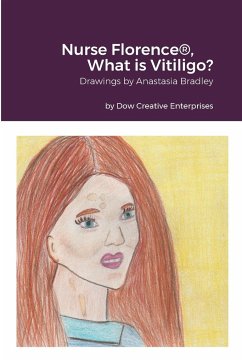 Nurse Florence®, What is Vitiligo? - Dow, Michael