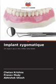 Implant zygomatique