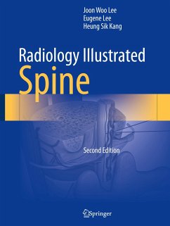 Radiology Illustrated: Spine - Lee, Joon Woo;Lee, Eugene;Kang, Heung Sik